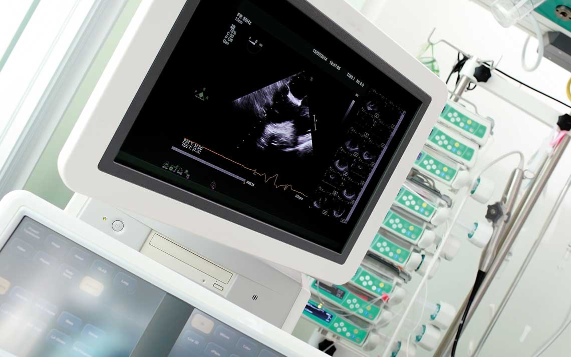 Ultrasound screen
