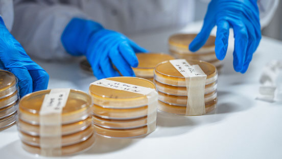 Medical Device Bioburden Testing