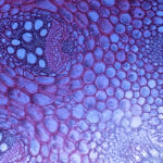 Are Biological Materials the Future of Implants? Image